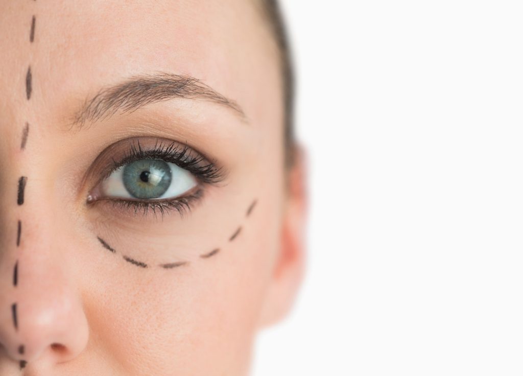 ocuplastia-min-2-1024x736